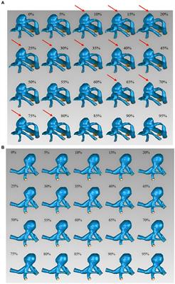 Relationships between irregular pulsation and variations in morphological characteristics during the cardiac cycle in unruptured intracranial aneurysms by 4D-CTA